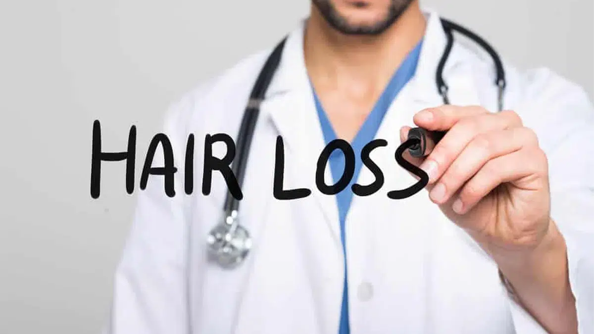 Do I Need a Hair Loss Doctor?