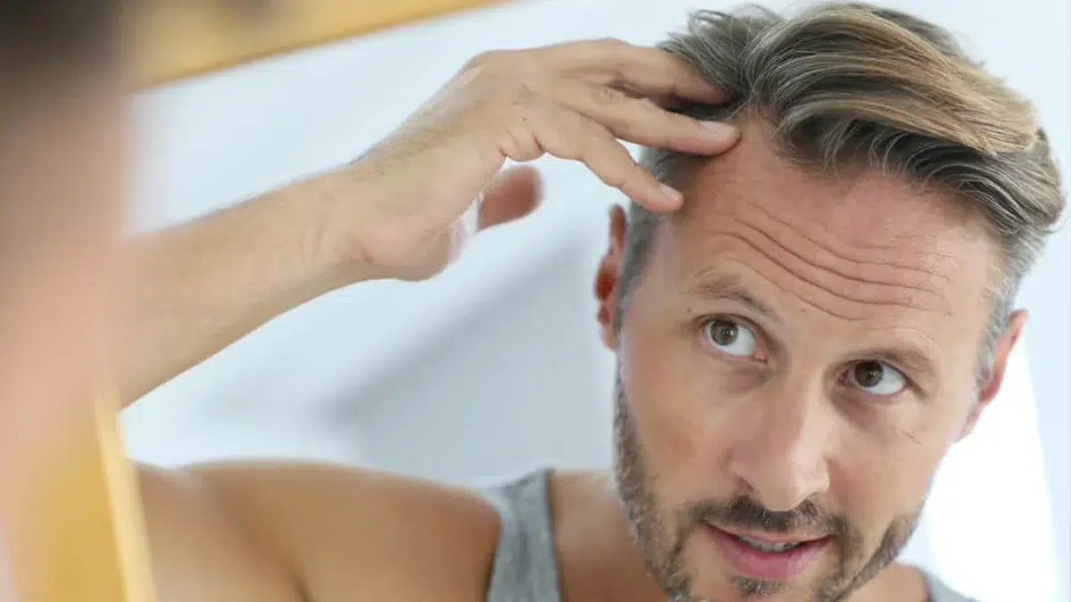 Exosome Therapy For Hair Loss