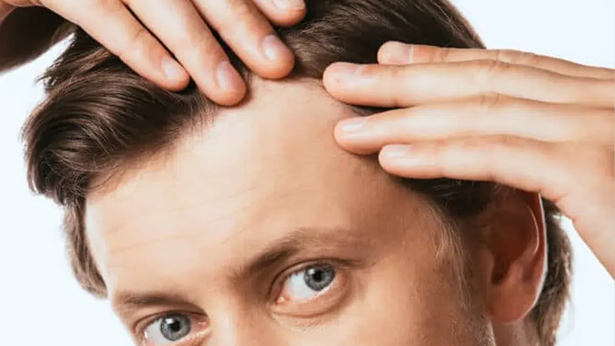 Separating Fact from Fiction About Hair Transplant Surgery