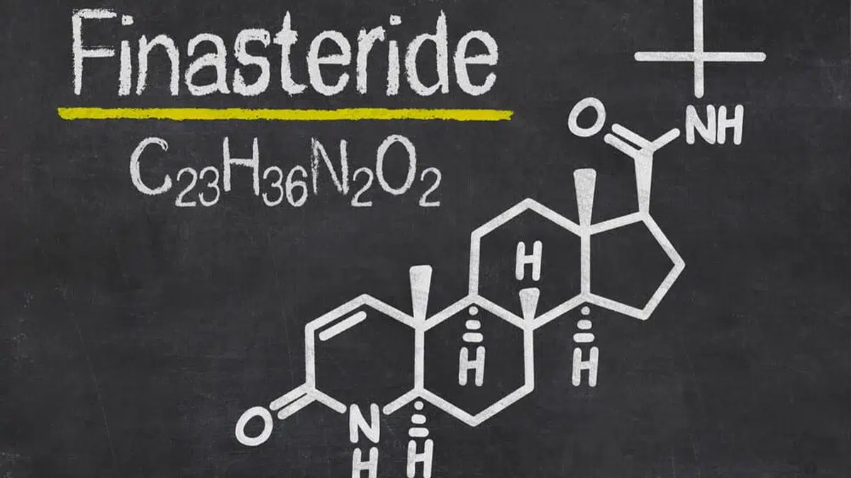 Finasteride Hair Restoration Product Has Worked for Me. Now What?