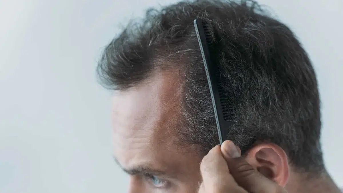 6 Habits That Cause Hair Loss