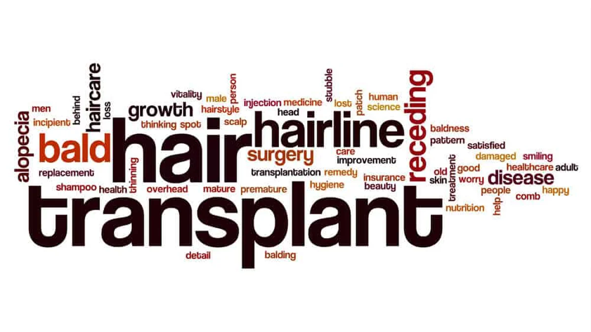 Is Hair Transplant a Permanent or Temporary Solution?