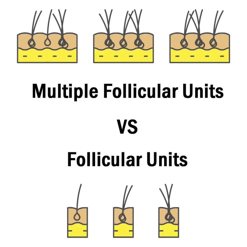 mfu-vs-fu-comparison