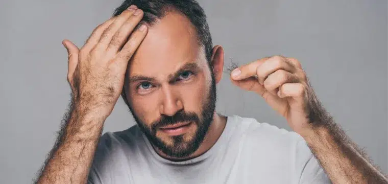 male-hair-loss-vs-female-hair-loss