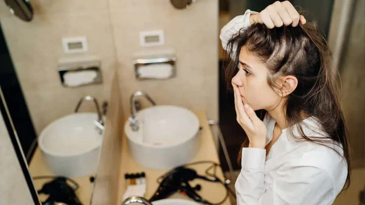 The 411 on Alopecia