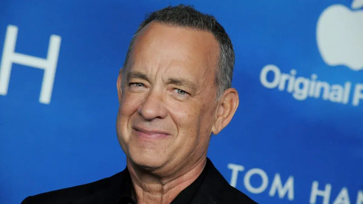 The Science Of Celebrity Hair Transplants: Exploring Tom Hanks’s Decision