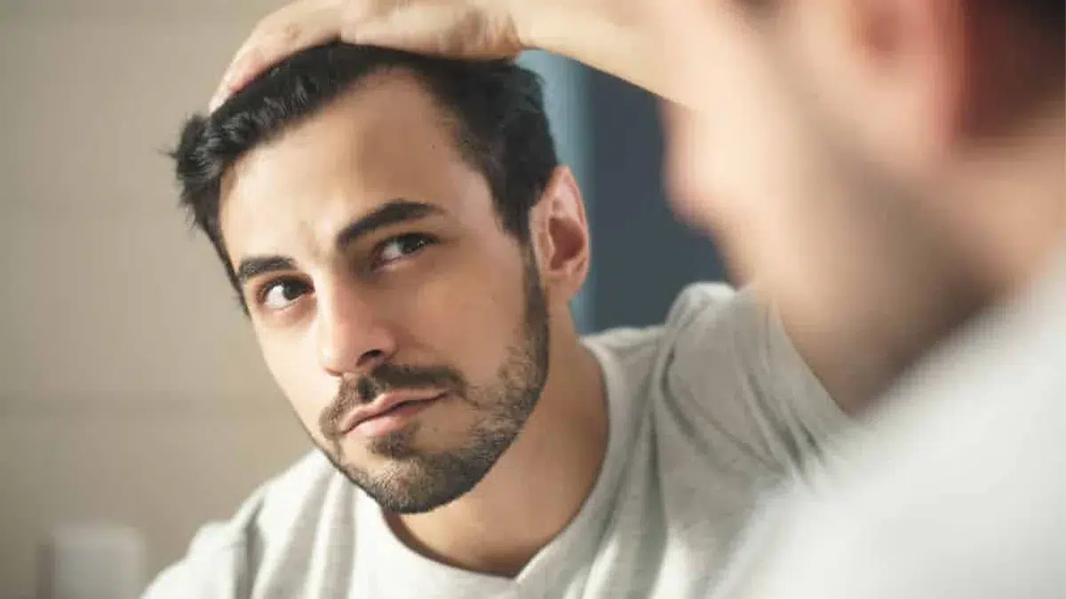 What Causes Hair Loss?