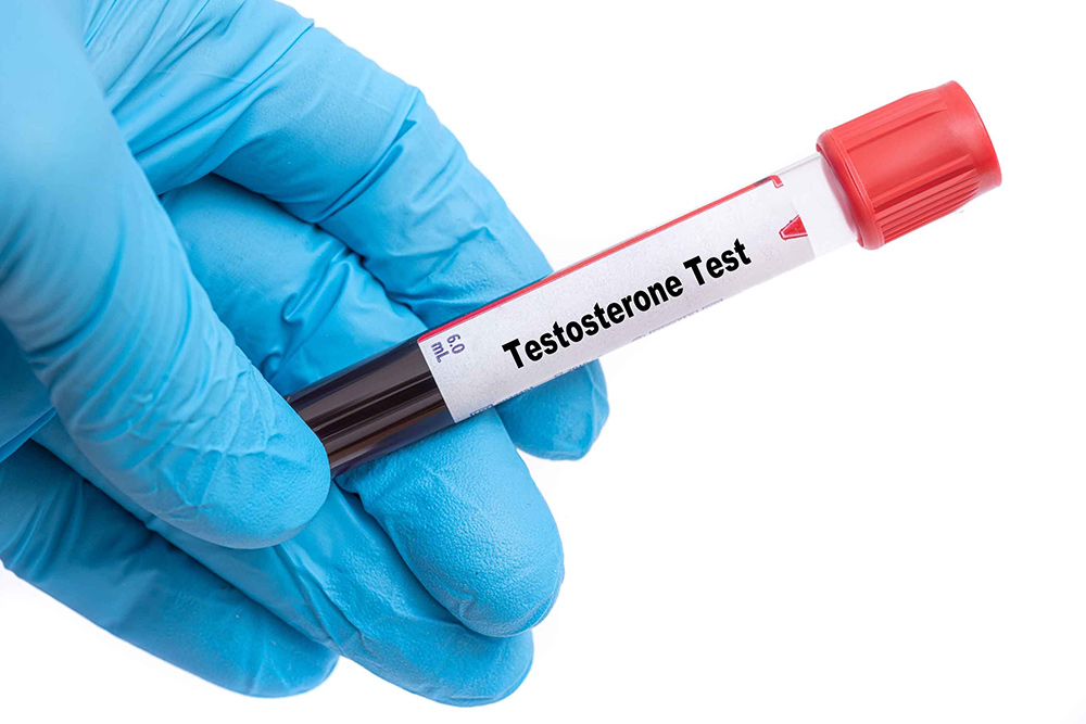 Link Between Testosterone Levels & Hair Loss | Hormone Related Hair Thinning In Men & Women | Hair Transplant | Hair Loss Treatment | DHT Blockers | Hair Growth Clinic Raleigh, NC