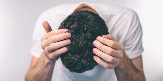 Does Creatine Cause Hair Loss | Male Pattern Balding | Hair Thinning Causes | Hair Transplant Clinic | ZA Hair Restoration Raleigh, North Carolina